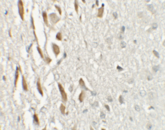 TSHZ3 Antibody in Immunohistochemistry (IHC)