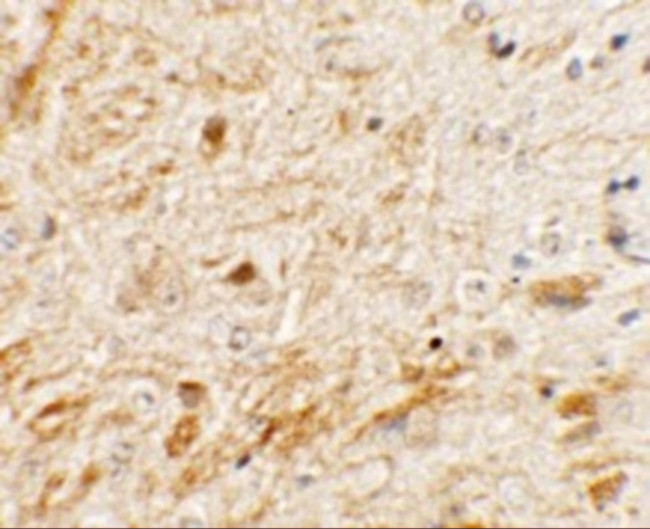 TMEM106A Antibody in Immunohistochemistry (IHC)