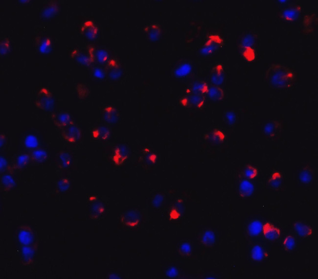 Dectin 1 Antibody in Immunocytochemistry (ICC/IF)