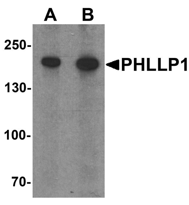 PHLPP1 Antibody in Western Blot (WB)