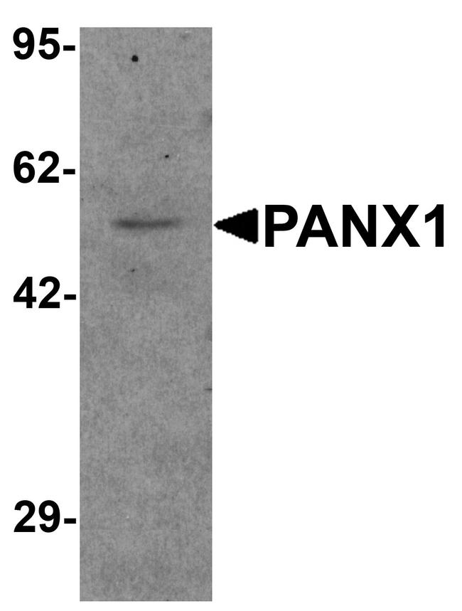 Pannexin 1 Antibody in Western Blot (WB)