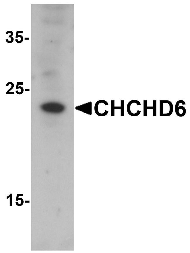 CHCHD6 Antibody in Western Blot (WB)