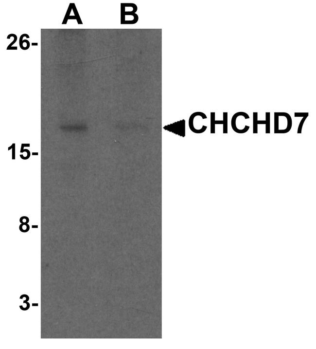 CHCHD7 Antibody in Western Blot (WB)