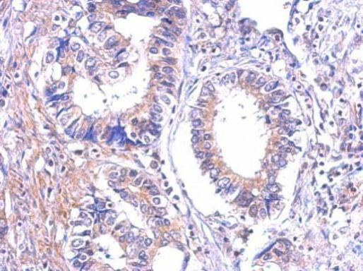 LTB4R Antibody in Immunohistochemistry (Paraffin) (IHC (P))