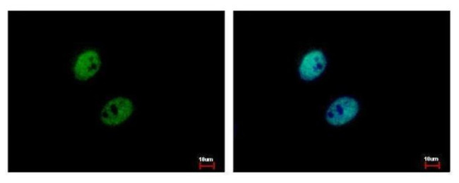 RAD17 Antibody in Immunocytochemistry (ICC/IF)