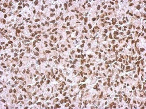 RAD17 Antibody in Immunohistochemistry (Paraffin) (IHC (P))