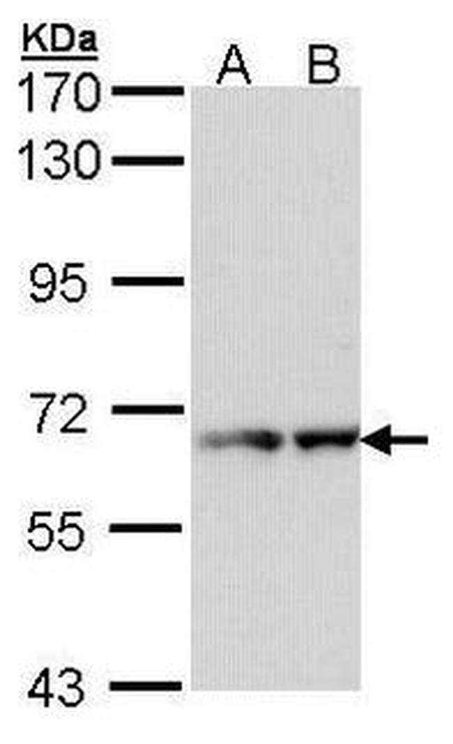 RAD17 Antibody in Western Blot (WB)