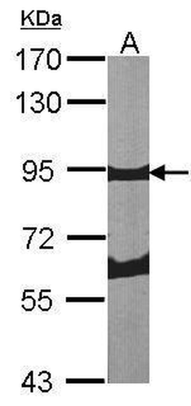 Periostin Antibody in Western Blot (WB)