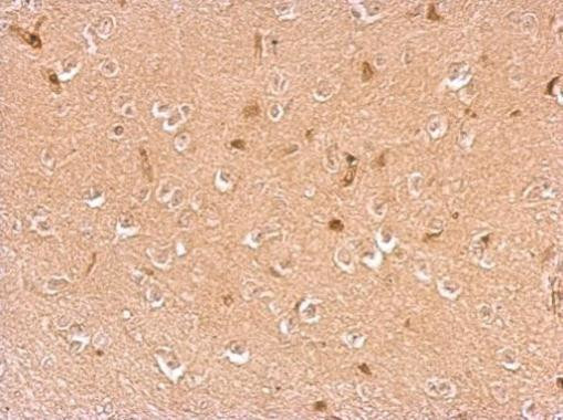 Dopamine beta Hydroxylase Antibody in Immunohistochemistry (Paraffin) (IHC (P))