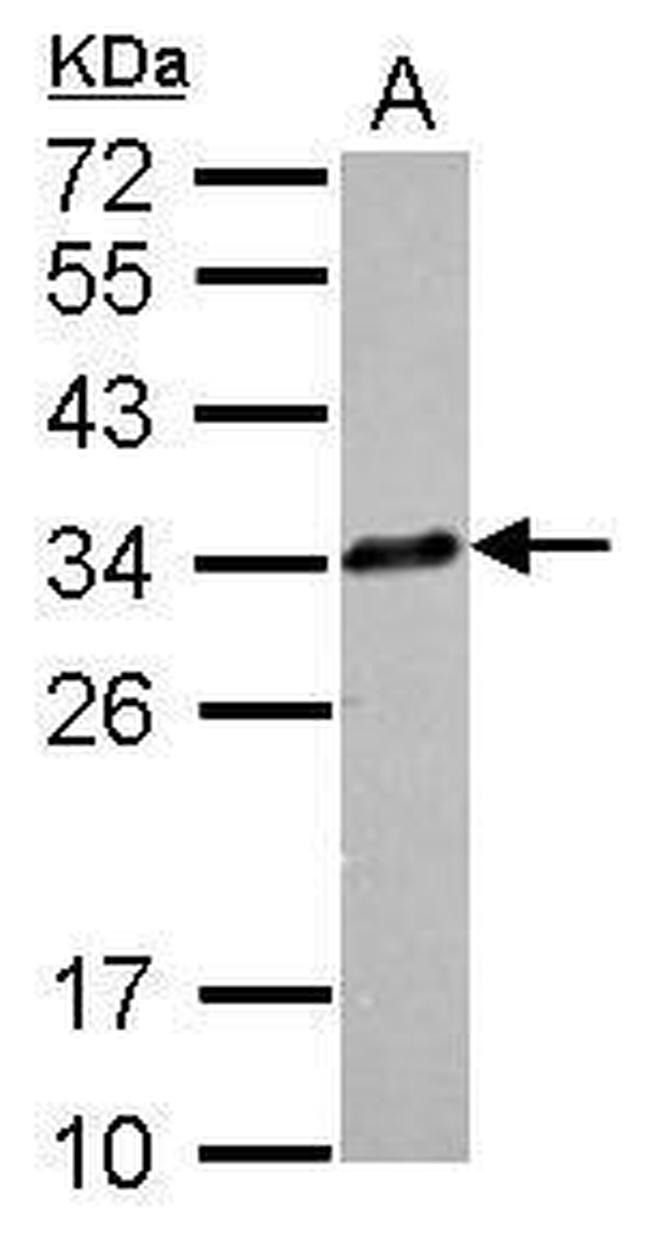 Clathrin Light Chain A Antibody in Western Blot (WB)