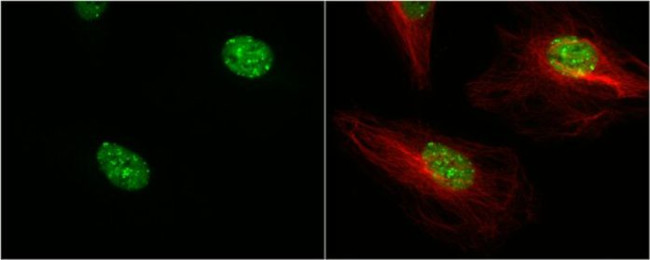 53BP1 Antibody in Immunocytochemistry (ICC/IF)