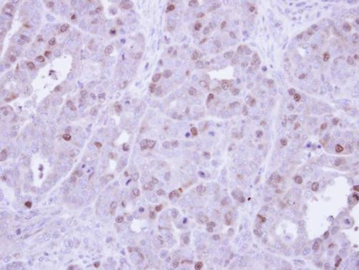 Cyclin A2 Antibody in Immunohistochemistry (Paraffin) (IHC (P))