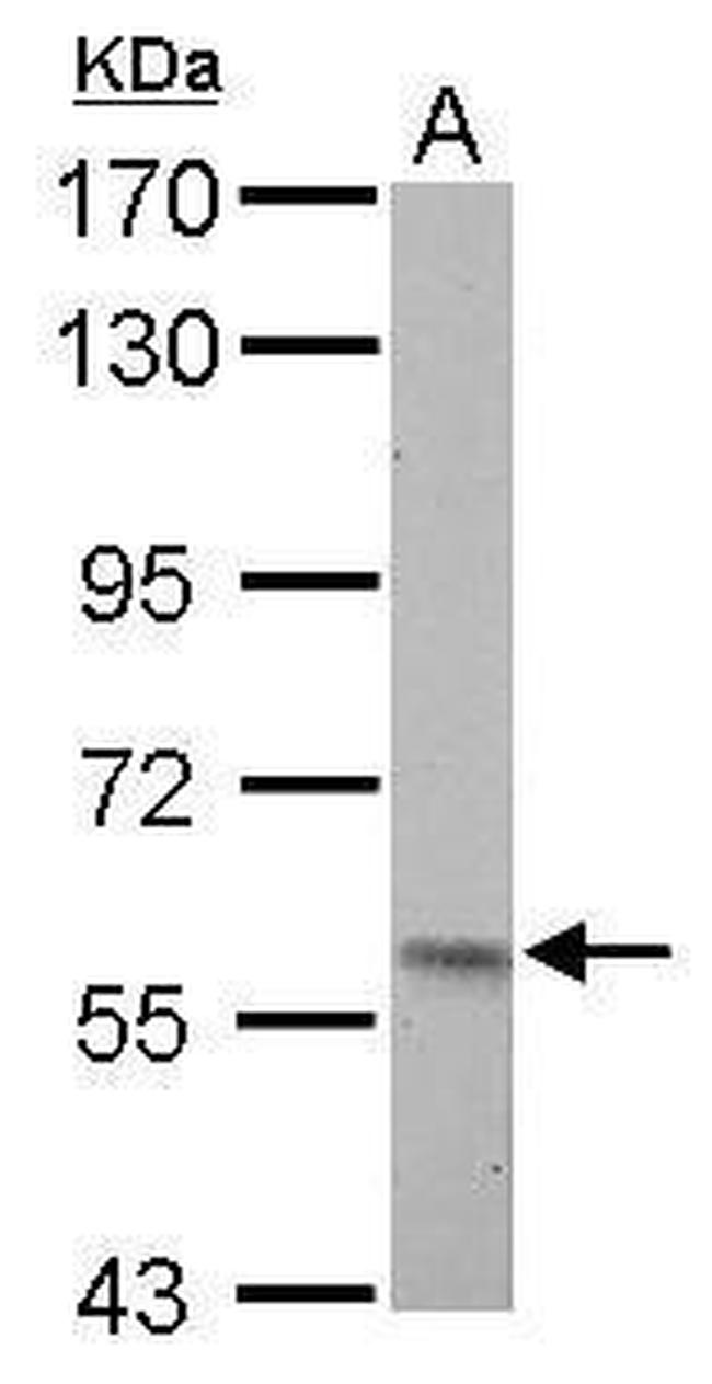 PKLR Antibody in Western Blot (WB)