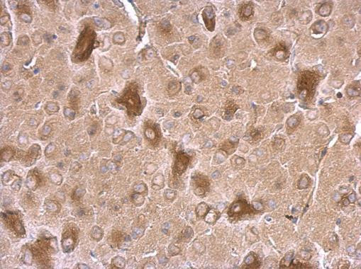 CRMP1 Antibody in Immunohistochemistry (Paraffin) (IHC (P))