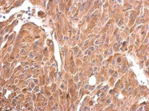 CRMP1 Antibody in Immunohistochemistry (Paraffin) (IHC (P))