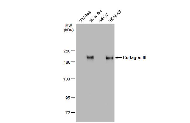 Collagen III Antibody in Western Blot (WB)