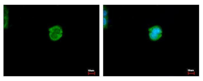 CES2 Antibody in Immunocytochemistry (ICC/IF)