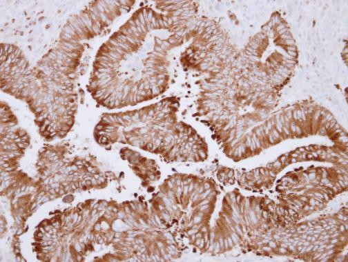 CES2 Antibody in Immunohistochemistry (Paraffin) (IHC (P))