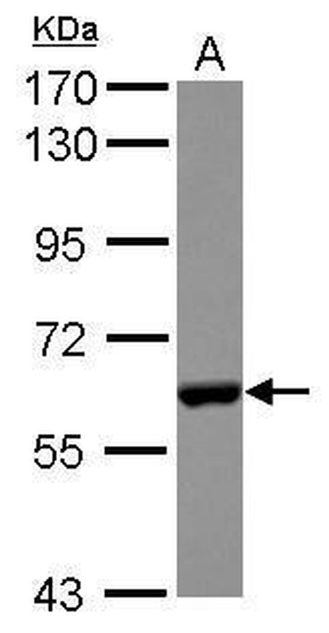 CES2 Antibody in Western Blot (WB)