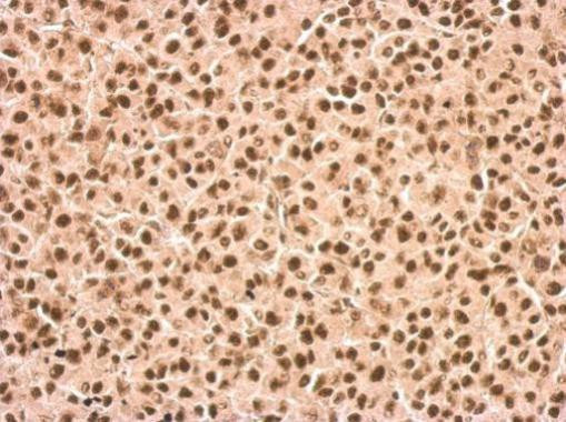 DDX23 Antibody in Immunohistochemistry (Paraffin) (IHC (P))