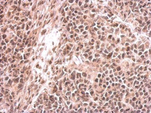 EHMT2 Antibody in Immunohistochemistry (Paraffin) (IHC (P))