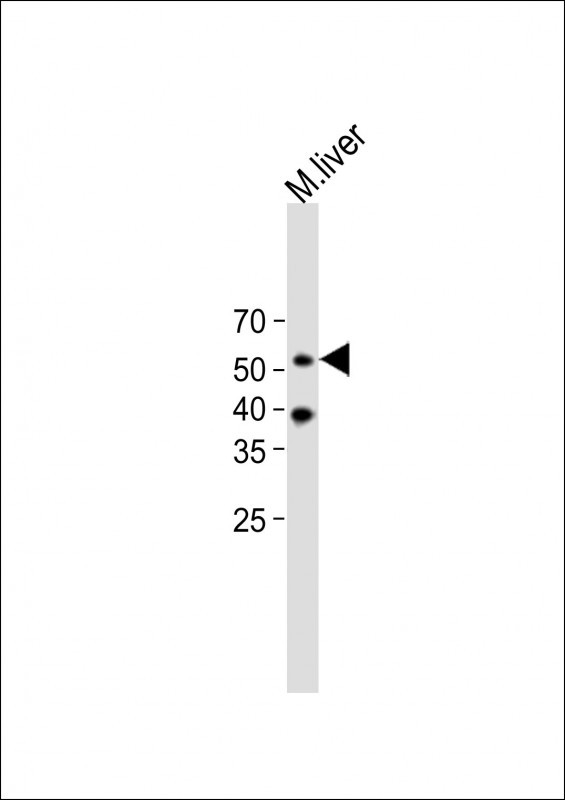 beta Arrestin 1 Antibody in Western Blot (WB)