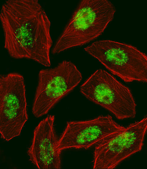 RFX1 Antibody in Immunocytochemistry (ICC/IF)