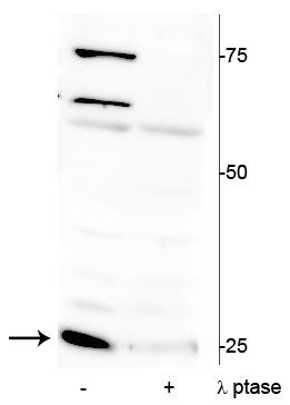 Phospho-Cardiac Troponin I (Ser150) Antibody in Western Blot (WB)