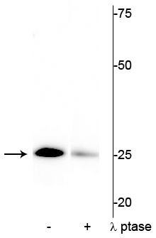 Phospho-Cardiac Troponin I (Ser43) Antibody in Western Blot (WB)