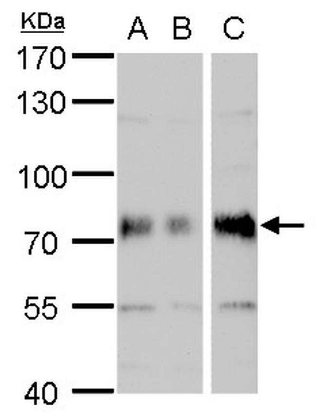 DMPK Antibody in Western Blot (WB)