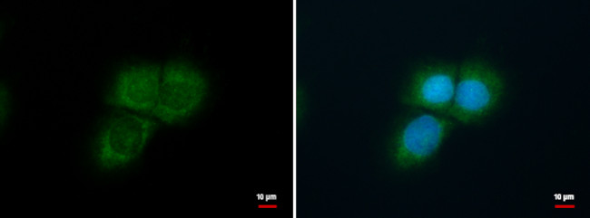 KF1 Antibody in Immunocytochemistry (ICC/IF)