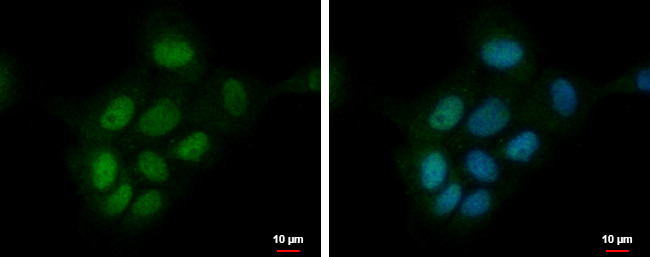 ZMYND8 Antibody in Immunocytochemistry (ICC/IF)