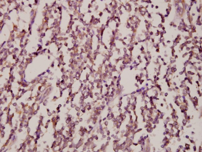 JNK1/JNK2/JNK3 Antibody in Immunohistochemistry (Paraffin) (IHC (P))