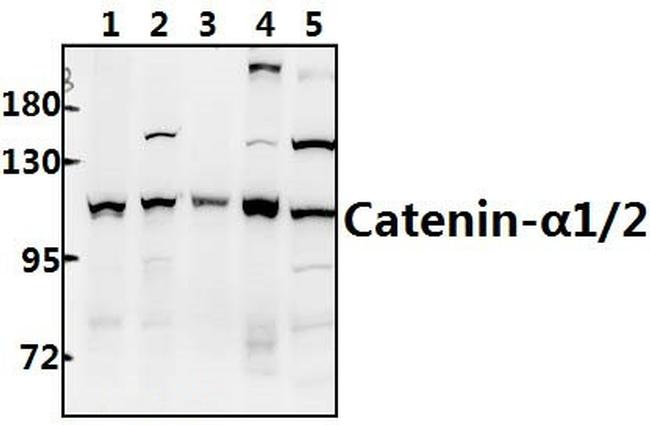 alpha Catenin Antibody in Western Blot (WB)