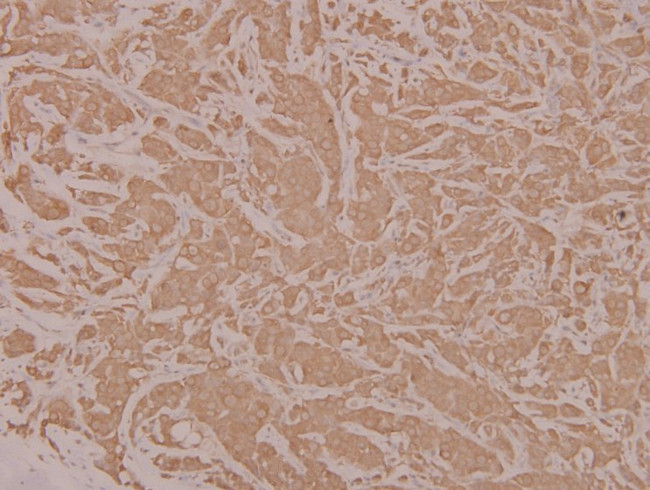 HYD Antibody in Immunohistochemistry (Paraffin) (IHC (P))