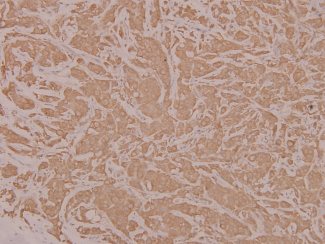 HYD Antibody in Immunohistochemistry (Paraffin) (IHC (P))