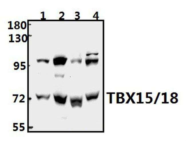 TBX15/TBX18 Antibody in Western Blot (WB)