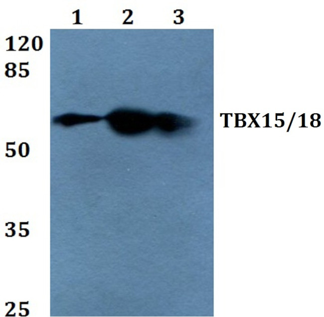 TBX15/TBX18 Antibody in Western Blot (WB)