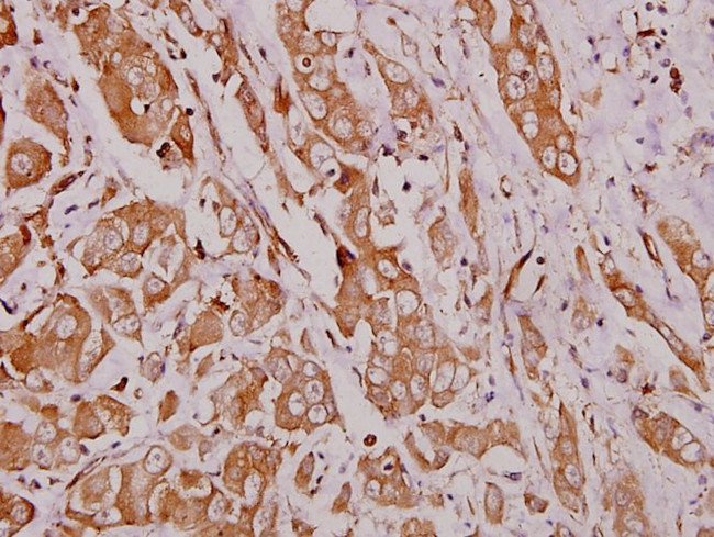 HEXB Antibody in Immunohistochemistry (Paraffin) (IHC (P))