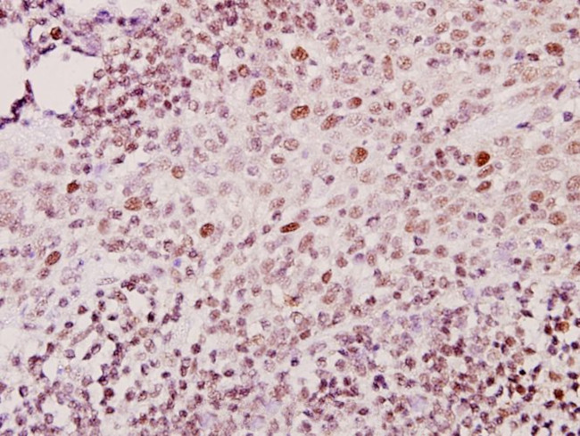 ZNF75D Antibody in Immunohistochemistry (Paraffin) (IHC (P))