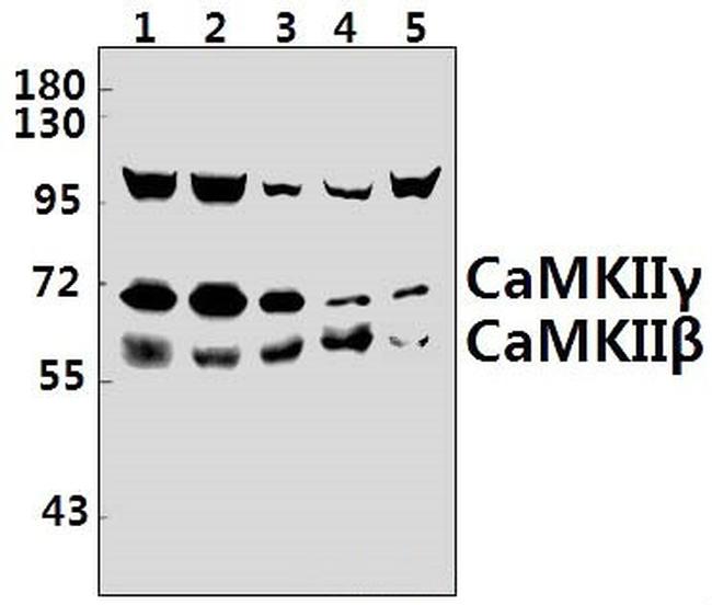 CaMKII beta/gamma Antibody in Western Blot (WB)