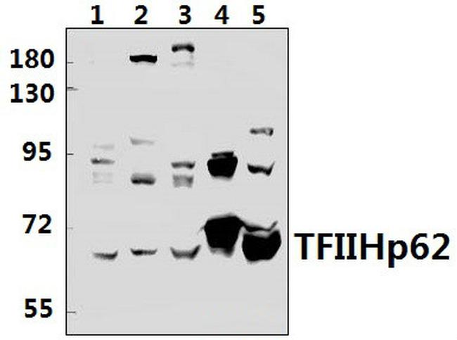 GTF2H1 Antibody in Western Blot (WB)