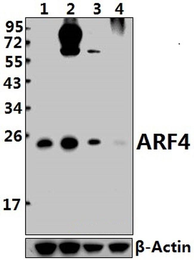 ARF4 Antibody in Western Blot (WB)