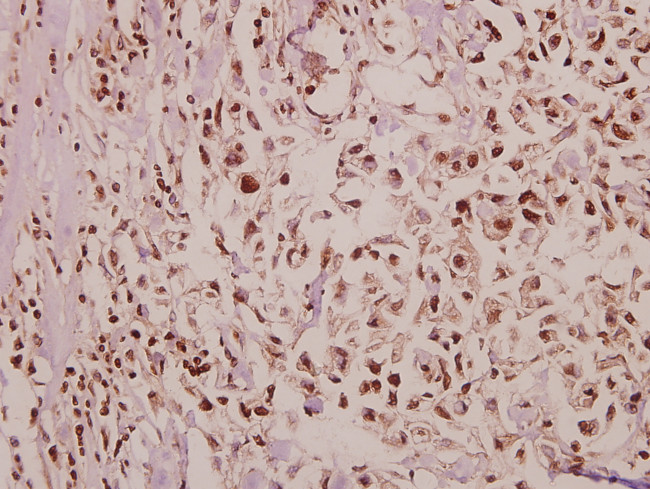 POM121 Antibody in Immunohistochemistry (Paraffin) (IHC (P))