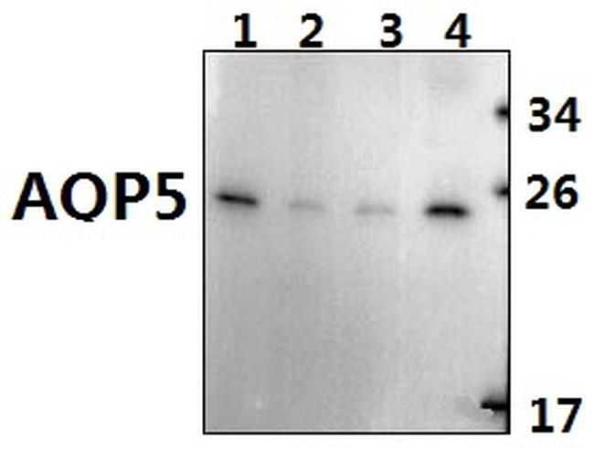 Aquaporin 5 Antibody in Western Blot (WB)