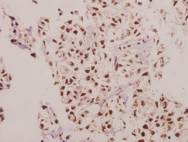 CPI-17 Antibody in Immunohistochemistry (Paraffin) (IHC (P))