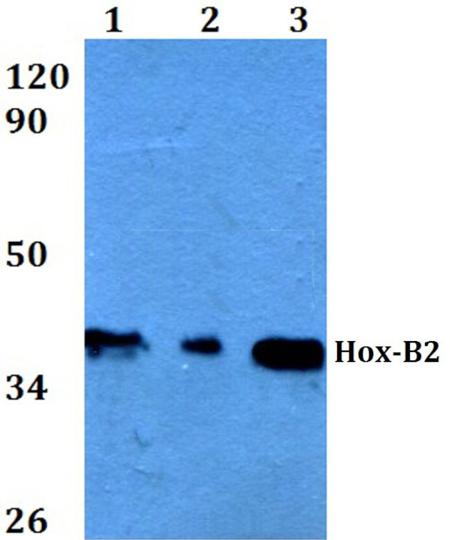 HOXB2 Antibody in Western Blot (WB)