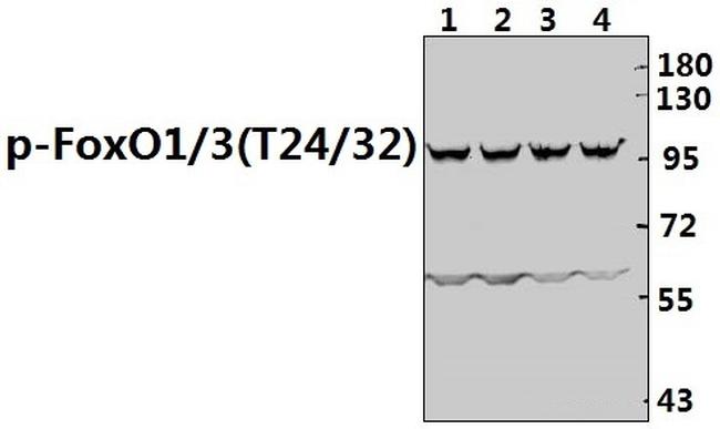 Phospho-FOXO1/FOXO3/FOXO4 (Thr24, Thr32) Antibody in Western Blot (WB)
