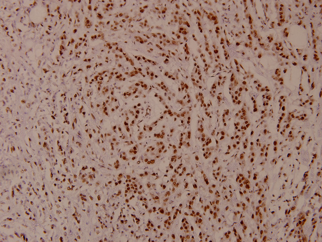 Phospho-STAT5 alpha/beta (Ser726, Ser731) Antibody in Immunohistochemistry (Paraffin) (IHC (P))