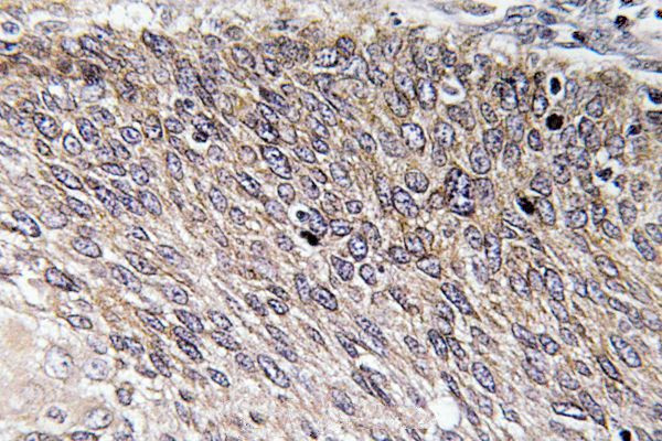 Phospho-VASP (Ser238) Antibody in Immunohistochemistry (Paraffin) (IHC (P))